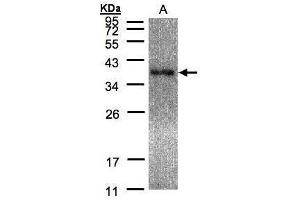 WB Image Sample(30 μg of whole cell lysate) A:Raji, 12% SDS PAGE antibody diluted at 1:5000 (EPM2A 抗体  (C-Term))