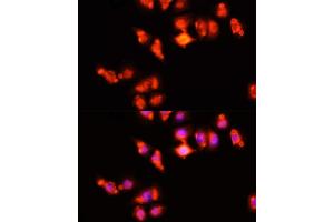 Immunofluorescence analysis of HeLa cells using HOX antibody (ABIN3017106, ABIN3017107, ABIN1680330 and ABIN6219956) at dilution of 1:100 (40x lens). (Homeobox A11 抗体  (AA 1-180))