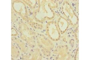 Immunohistochemistry of paraffin-embedded human kidney tissue using ABIN7159655 at dilution of 1:100 (MMACHC 抗体  (AA 63-282))