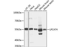 Western blot analysis of extracts of various cell lines, using LPC antibody (ABIN7268338) at 1:3000 dilution. (LPCAT4 抗体  (AA 345-524))