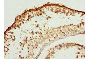 Immunohistochemistry of paraffin-embedded human testis tissue using ABIN7145239 at dilution of 1:100 (BBS2 抗体  (AA 1-96))