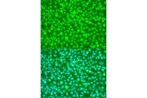 Immunofluorescence analysis of U2OS cells using N4BP1 antibody. (N4BP1 抗体  (AA 190-590))