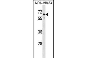 CATSPER2 Antibody (C-term) (ABIN1537377 and ABIN2850383) western blot analysis in MDA-M cell line lysates (35 μg/lane). (CATSPER2 抗体  (C-Term))