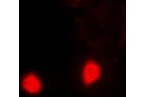 Immunofluorescent analysis of PSMD10 staining in Hela cells. (PSMD10 抗体)