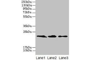 Western blot All lanes: CLDN20 antibody at 4 μg/mL Lane 1: A549 whole cell lysate Lane 2: HepG2 whole cell lysate Lane 3: PC-3 whole cell lysate Secondary Goat polyclonal to rabbit IgG at 1/10000 dilution Predicted band size: 24 kDa Observed band size: 24 kDa (Claudin 2 抗体  (AA 29-81))