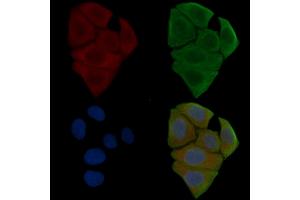 ABIN6255732 and ABIN6267570 staining Hela cells(30 min of UV treatment) by IF/ICC. (ADAM17 抗体  (pThr735))
