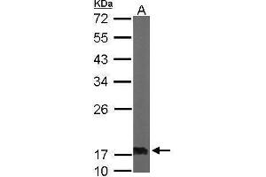 WB Image Sample (50 ug of whole cell lysate) A: Mouse brain 12% SDS PAGE antibody diluted at 1:1000 (NME2 抗体  (Center))