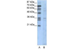 CCNB3 antibody (20R-1100) used at 0. (Cyclin B3 抗体  (N-Term))