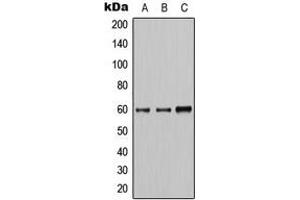 Western blot analysis of AKT expression in HeLa (A), A549 (B), HepG2 (C) whole cell lysates. (AKT1 抗体  (Center))