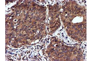 Image no. 9 for anti-NADH Dehydrogenase (Ubiquinone) Complex I, Assembly Factor 7 (NDUFAF7) antibody (ABIN1499667) (NDUFAF7 抗体)