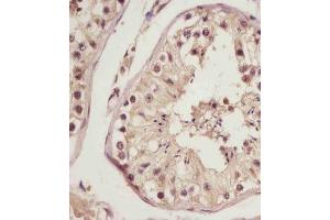 (ABIN6243401 and ABIN6578787) staining NSFL1C in human testis tissue sections by Immunohistochemistry (IHC-P - paraformaldehyde-fixed, paraffin-embedded sections). (NSFL1C 抗体  (AA 37-71))