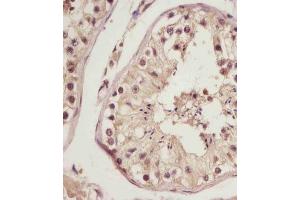 (ABIN6243401 and ABIN6578787) staining NSFL1C in human testis tissue sections by Immunohistochemistry (IHC-P - paraformaldehyde-fixed, paraffin-embedded sections).