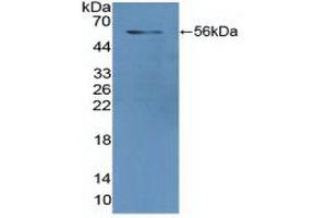 Detection of Recombinant GR, Human using Polyclonal Antibody to Glutathione Reductase (GR) (Glutathione Reductase 抗体  (AA 44-522))