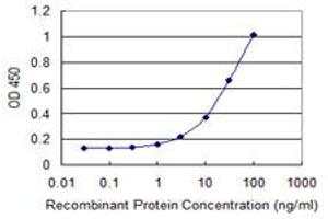 Detection limit for recombinant GST tagged SGOL1 is 0. (Shugoshin 抗体  (AA 1-292))
