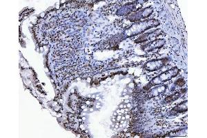 IHC analysis of CTBP2 using anti-CTBP2 antibody (ABIN7601326). (CTBP2 抗体  (AA 321-445))