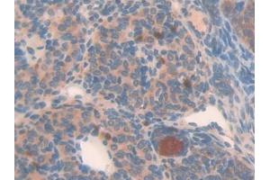 DAB staining on IHC-P; Samples: Mouse Placenta Tissue (NAIP 抗体  (AA 500-759))