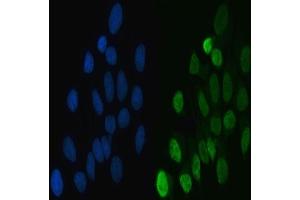 IF analysis of hnRNP L/HNRNPL using anti-hnRNP L/HNRNPL antibody (ABIN7600130).