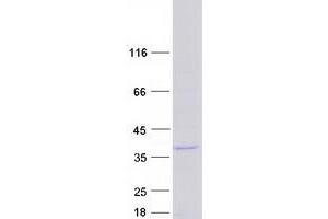 Western Blotting (WB) image for Family with Sequence Similarity 110, Member A (FAM110A) (Transcript Variant 2) protein (Myc-DYKDDDDK Tag) (ABIN2720731)