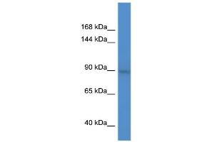 WB Suggested Anti-BCL11A Antibody Titration:  0. (BCL11A 抗体  (C-Term))