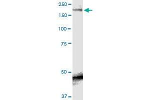Western Blotting (WB) image for anti-Sodium Channel, Voltage-Gated, Type IX, alpha Subunit (SCN9A) (AA 269-339) antibody (ABIN562807)