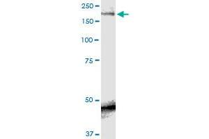 SCN9A monoclonal antibody (M01), clone 5A11. (SCN9A 抗体  (AA 269-339))