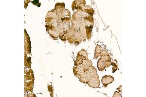 Immunohistochemistry of paraffin-embedded mouse skeletal muscle using CLCN1 Rabbit pAb (ABIN6130939, ABIN6138661, ABIN6138662 and ABIN6221409) at dilution of 1:200 (40x lens). (CLCN1 抗体  (AA 779-988))