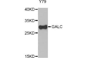 Western Blotting (WB) image for anti-Galactosylceramidase (GALC) (AA 40-300) antibody (ABIN1679950) (GALC 抗体  (AA 40-300))