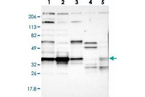 Western blot analysis of Lane 1: RT-4, Lane 2: U-251 MG, Lane 3: A-431, Lane 4: Liver, Lane 5: Tonsil with CCDC50 polyclonal antibody  at 1:250-1:500 dilution. (CCDC50 抗体)