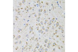 Immunohistochemistry of paraffin-embedded mouse brain using MTTP antibody. (MTTP 抗体)
