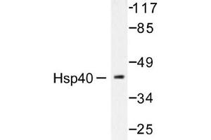 Image no. 2 for anti-DnaJ (Hsp40) Homolog, Subfamily B, Member 1 (DNAJB1) antibody (ABIN265471) (DNAJB1 抗体)