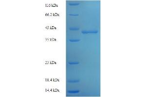 SDS-PAGE (SDS) image for Polymerase (RNA) III (DNA Directed) Polypeptide A, 155kDa (POLR3A) (AA 392-632), (partial) protein (His-SUMO Tag) (ABIN5710123)