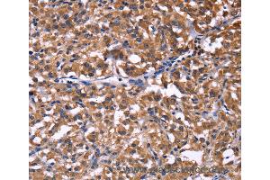 Immunohistochemistry of Human brain  using SELPLG Polyclonal Antibody at dilution of 1:50 (SELPLG 抗体)