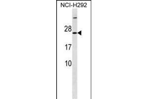 MRPS23 Antibody (Center) (ABIN1538455 and ABIN2849850) western blot analysis in NCI- cell line lysates (35 μg/lane). (MRPS23 抗体  (AA 50-76))