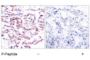 Image no. 1 for anti-Activating Transcription Factor 2 (ATF2) (pThr53), (pThr71) antibody (ABIN196667) (ATF2 抗体  (pThr53, pThr71))