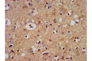 IHC image of ABIN7169072 diluted at 1:500 and staining in paraffin-embedded human brain tissue performed on a Leica BondTM system. (CDC42BPB 抗体  (AA 1609-1711))