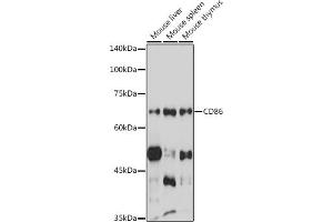 Western blot analysis of extracts of various cell lines, using CD86 antibody (ABIN6131556, ABIN6138237, ABIN6138238 and ABIN6219508) at 1:1000 dilution. (CD86 抗体  (AA 30-247))