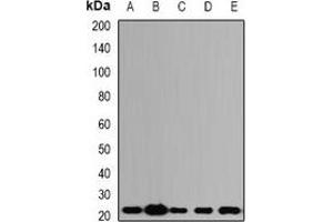 Western blot analysis of ALG-2 expression in SW620 (A), HepG2 (B), mouse kidney (C), mouse lung (D), rat ovary (E) whole cell lysates. (ALG2 抗体)