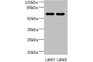 Western blot All lanes: ZNF215 antibody at 3 μg/mL Lane 1: Hela whole cell lysate Lane 2: A431 whole cell lysate Secondary Goat polyclonal to rabbit IgG at 1/10000 dilution Predicted band size: 61, 36 kDa Observed band size: 61 kDa (ZNF215 抗体  (AA 12-304))