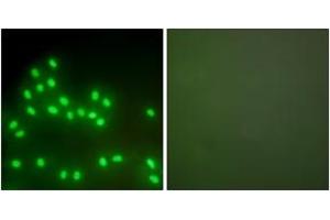 Immunofluorescence analysis of A549 cells, using Ku70/80 Antibody. (Ku70/80 (AA 683-732) 抗体)