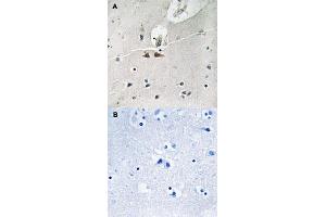 Immunohistochemical staining of human brain tissue by EFNB1/EFNB2/EFNB3 (phospho Y324) polyclonal antibody  without blocking peptide (A) or preincubated with blocking peptide (B) under 1:50-1:100 dilution.