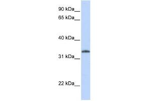 WB Suggested Anti-UCK2 Antibody Titration:  0. (UCK2 抗体  (N-Term))