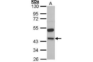 WB Image Sample (30 ug of whole cell lysate) A: Molt-4 , 10% SDS PAGE antibody diluted at 1:1000 (KNG1 抗体)
