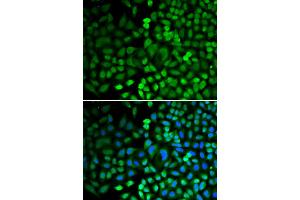 Immunofluorescence analysis of HeLa cells using APEX1 antibody (ABIN5970467). (APEX1 抗体)