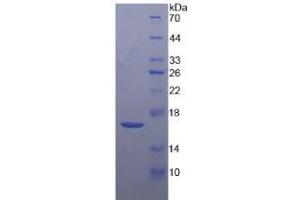 SDS-PAGE analysis of Mouse CRH Protein. (CRH 蛋白)