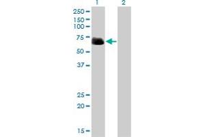 Western Blot analysis of RIPK2 expression in transfected 293T cell line by RIPK2 monoclonal antibody (M01), clone 2C7. (RIPK2 抗体  (AA 431-540))