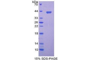 SDS-PAGE (SDS) image for Chemokine (C-C Motif) Ligand 3-Like 1 (CCL3L1) (AA 1-93) protein (His tag,GST tag) (ABIN2122609)
