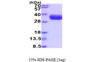 SDS-PAGE (SDS) image for Kallikrein 5 (KLK5) (AA 67-293) protein (His tag) (ABIN5854782) (Kallikrein 5 Protein (KLK5) (AA 67-293) (His tag))