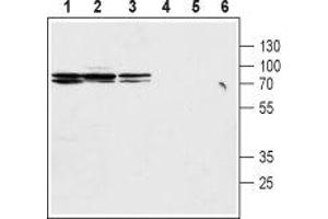 Western blot analysis of rat kidney membranes (lanes 1 and 4), mouse kidney lysates (lanes 2 and 5) and rat stomach lysates (lanes 3 and 6): - 1-3. (SLC9A2 抗体  (C-Term, Intracellular))
