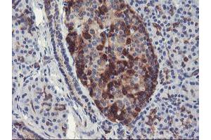 Immunohistochemical staining of paraffin-embedded Human pancreas tissue using anti-PFKP mouse monoclonal antibody. (PFKP 抗体)