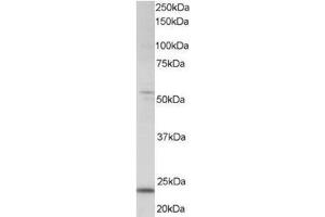 Image no. 1 for anti-MAX Dimerization Protein 4 (MXD4) (C-Term) antibody (ABIN374270) (MXD4 抗体  (C-Term))